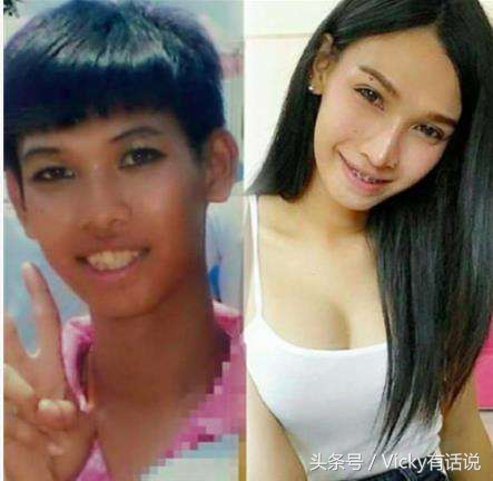 泰国人妖变性手术后寿命长吗,泰国人妖无死角变性手术