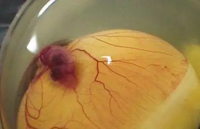 鸡蛋虽好但这7种蛋最好别吃,吃蛋有什么坏处