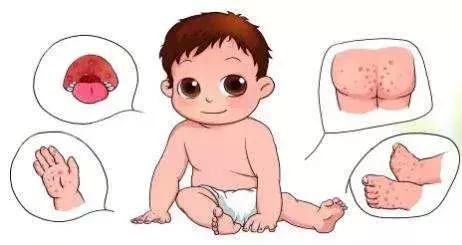 广西恙虫高发期,危险警告八种毒虫