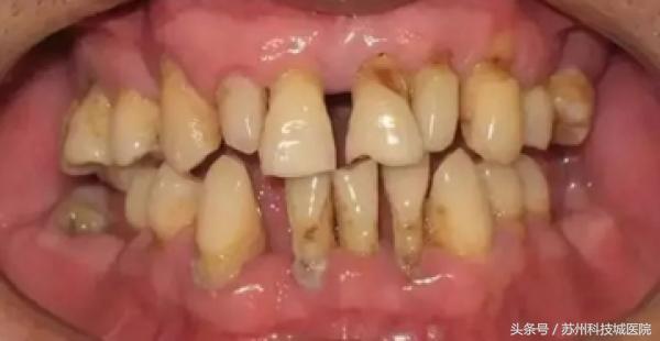 门牙有道缝，美丽关不住