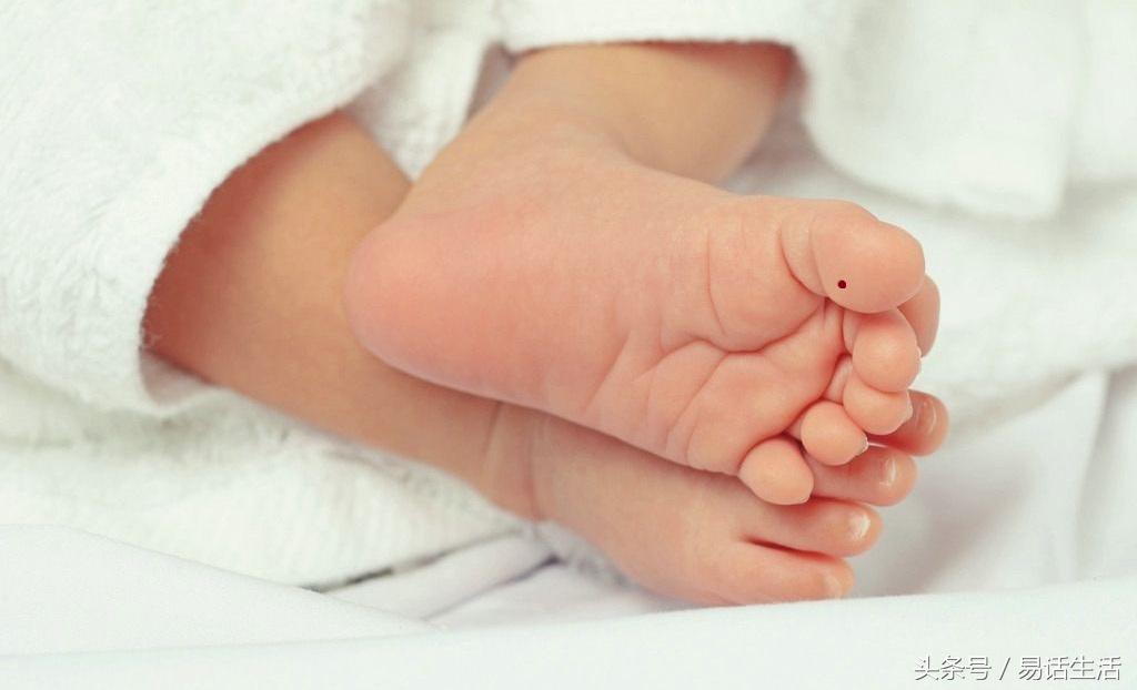 脚指有痣、脚跟有痣、脚底有痣、趾缝有痣的人,恭喜!