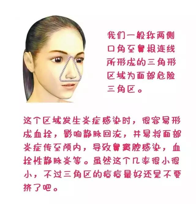 痘痘贴是怎么祛痘的,痘痘贴消炎最快方法