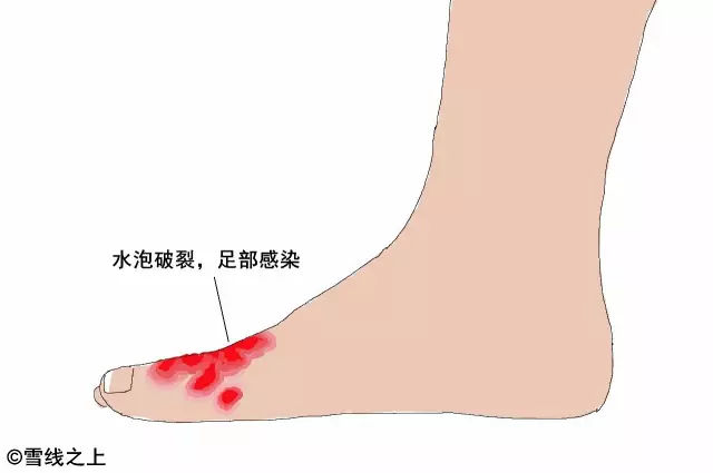 陶冶徒步最佳路线,陶冶户外徒步挑战赛