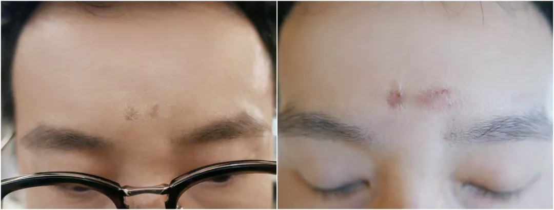 法国“奇愈”|只需一晚就能治愈痘印的地方,你想去吗?