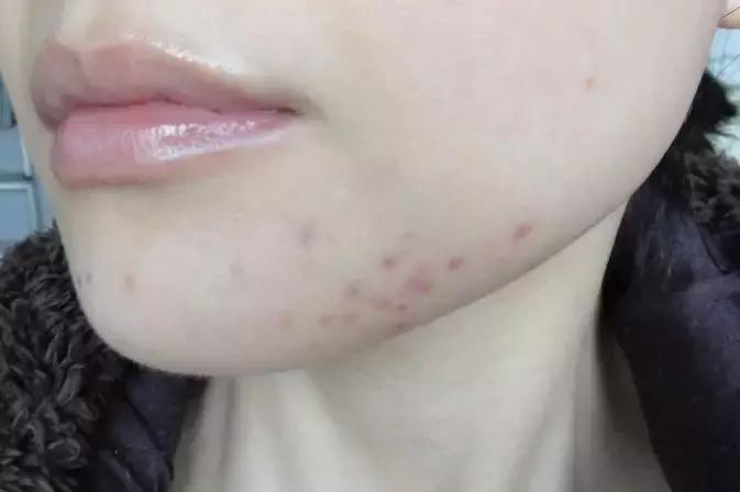 再来一波抗衰科普,你是不是对面部抗衰有什么误解