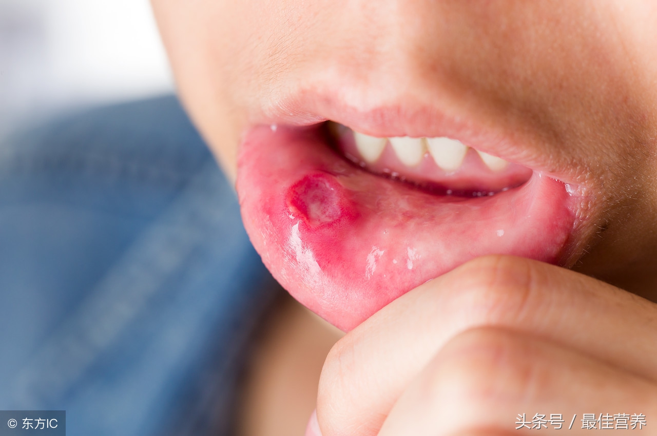 经常头晕头痛记忆力下降烦躁不安,头痛口干舌燥没有食欲怎么回事