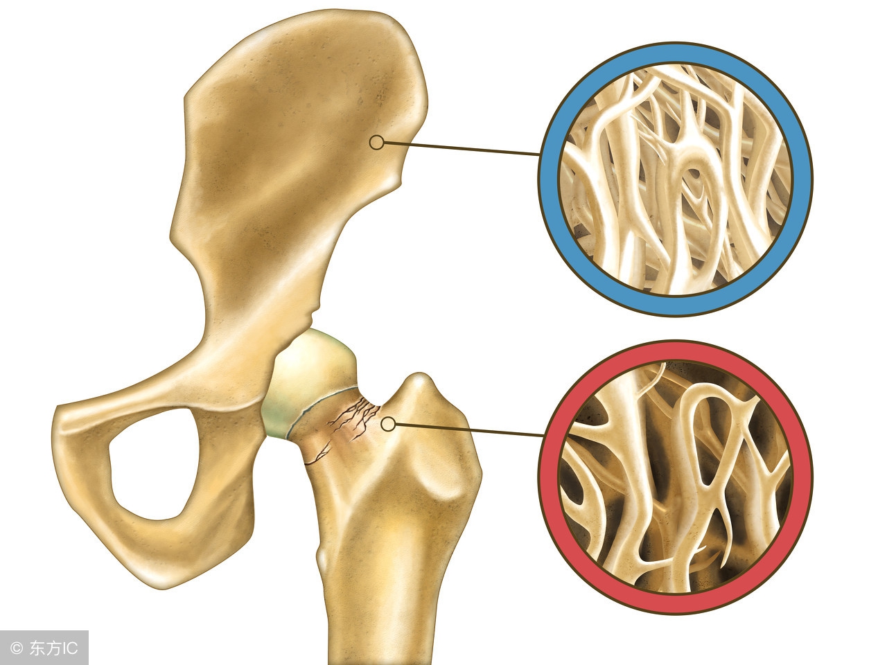 更年期是妇科三大恶性肿瘤的高发年龄,应该提高警惕