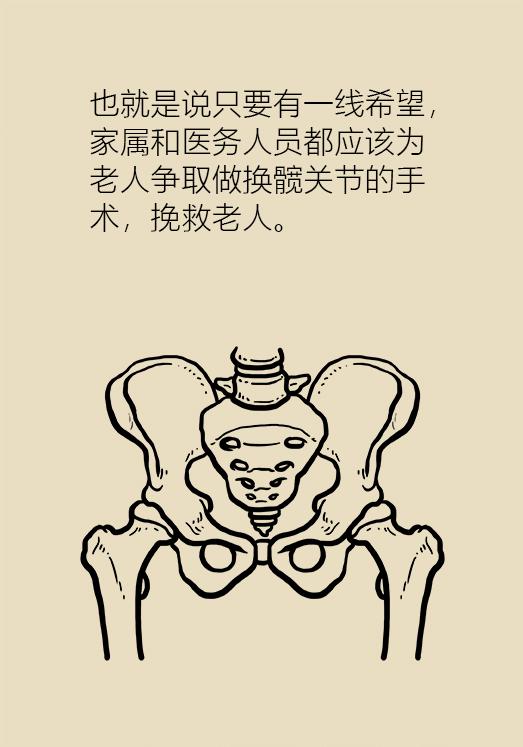老人股骨颈骨折后死亡率高达50%，提醒爸妈一定要注意！