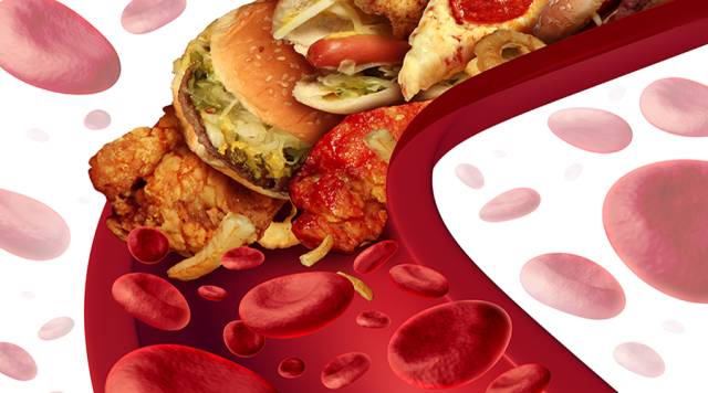 清理血管垃圾你知道几种方法 (到底有没有清理血管垃圾的方法)