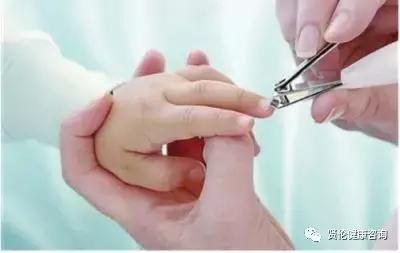 为新妈咪做婴儿湿疹护理的指导,对付湿疹口服的特效药