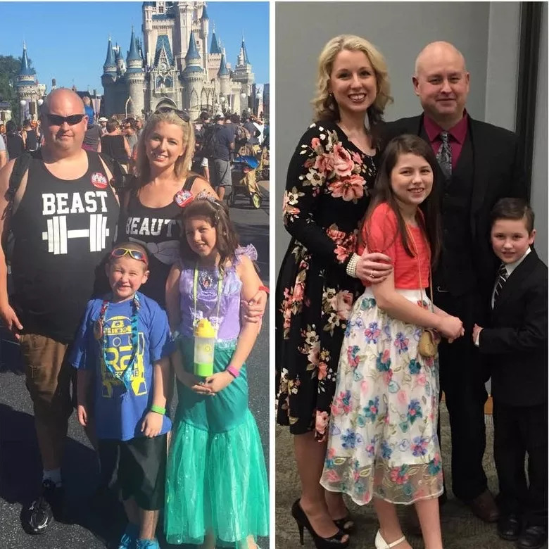 多动儿童生酮饮食法,多动症和吃得多有关系吗