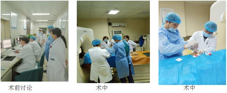 碘125粒子植入术教授,碘125粒子植入术引入中国