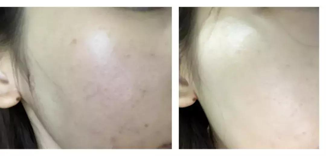 妍丽的绿安瓶,妍丽护肤品靠谱吗