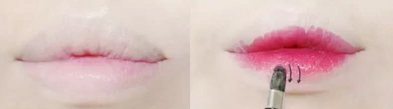 唇上斑怎么去除男生,唇上黑怎么去除男生