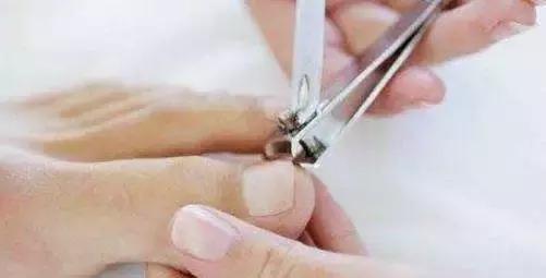 脚磨破皮不爱愈合，医生说怕是得了这种病！真希望你早点发现