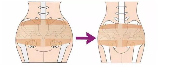 产后腰围能自动恢复吗,做了产后修复腰围少了3cm