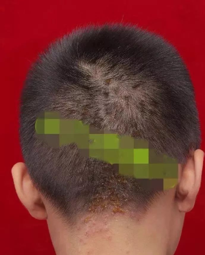 六安外国语学校小学生宿舍,六安外国语学校寄宿