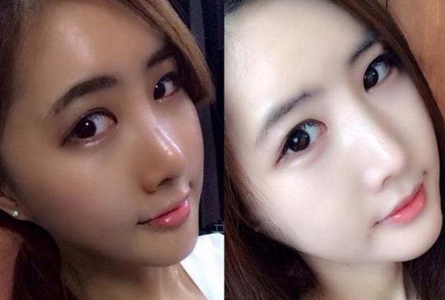 小药店里的它擦脸一周后皮肤白嫩,睡前用它擦脸3天皮肤变年轻