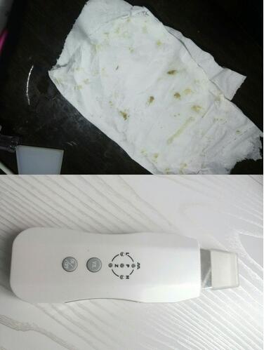 推荐去黑头神器小学生,去黑头好物推荐学生党平价