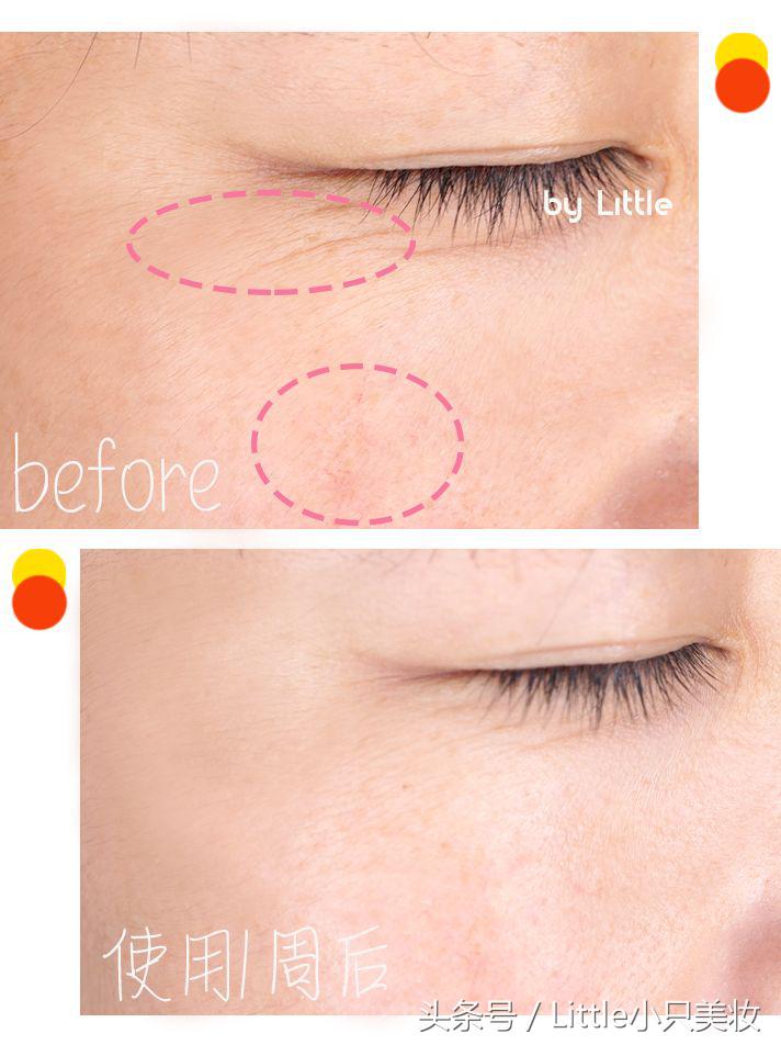 泛红痒敏感出油长痘推荐护肤项目,干燥起皮泛红护肤品