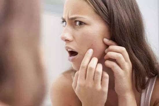 长痘后的痘印怎么办,长痘后留下痘印怎么去除