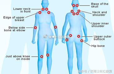 运动康复主诉,锻炼后肌肉酸疼怎么快速恢复