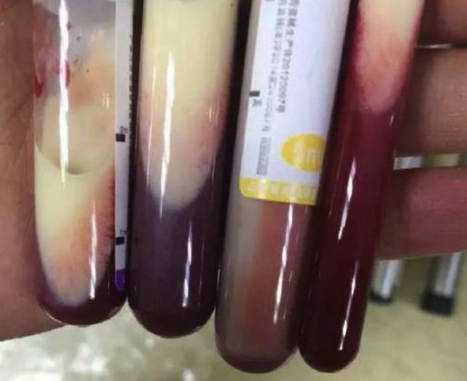 好好吃饭才是最好的爱自己,好好吃饭就是对生命的最好尊重