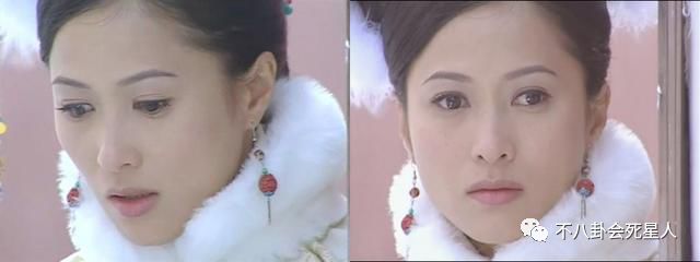 天生斜视参加选美，后成顶级打女被烧伤，当红时退圈为救患癌父亲