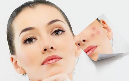 网红疤痕膏的危害,网红祛痘膏到底有没有用