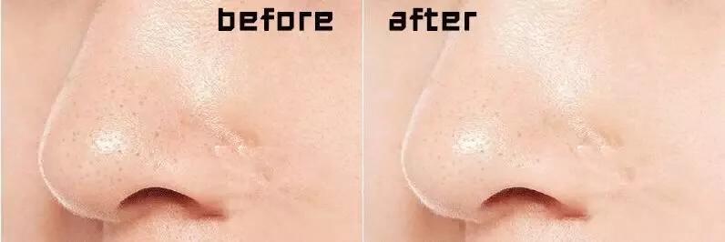 看似好用实则鸡肋的产品,盘点不好用的鸡肋产品