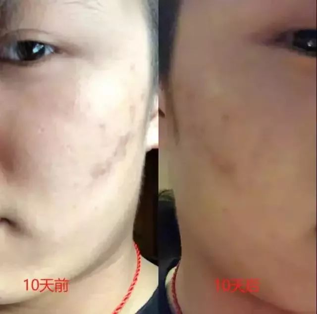 豆浆牛奶苹果汁的营养,适合春天喝的营养豆浆