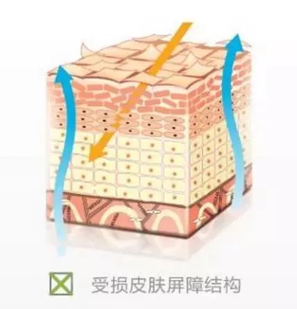 秋季孩子身上痒是什么原因,夏天宝宝身上总是痒怎么回事