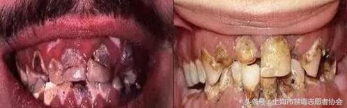 毒言毒语大全,一口烂牙你们郁闷吗