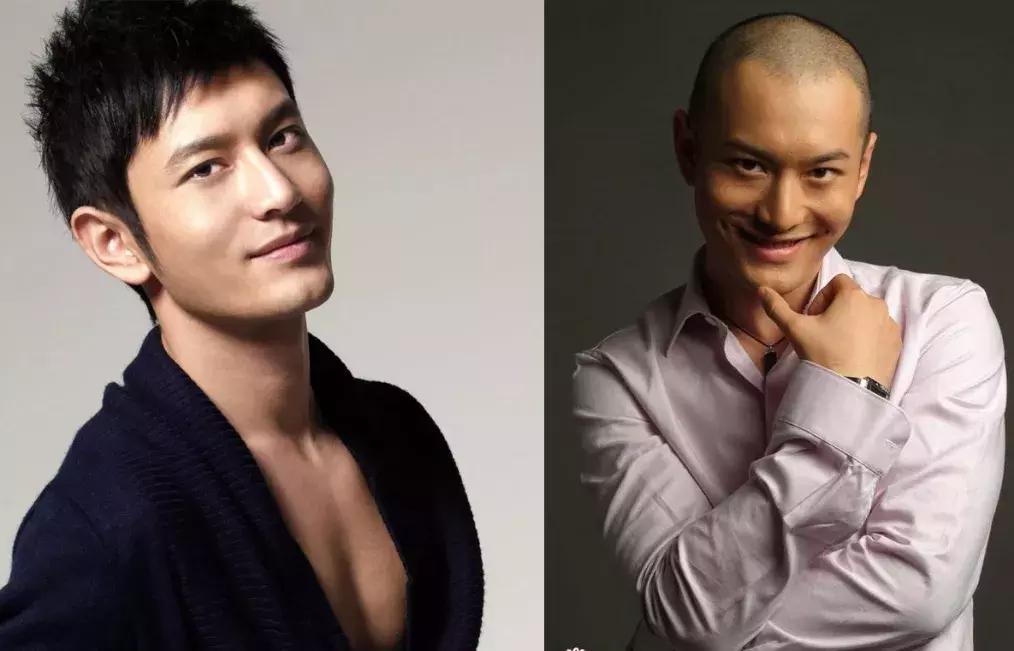 有许多明星脱发是怎样补救的,明星脱发都用什么方法