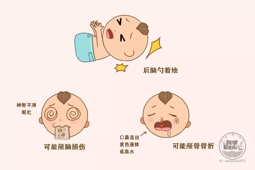 宝宝后脑勺摔了怎么判断有没有事,宝宝后脑勺着地摔了会影响小脑吗