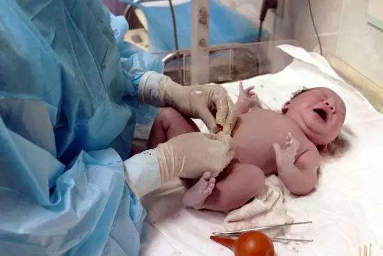 注意：新生儿这11个症状，都是正常现象，不用就医