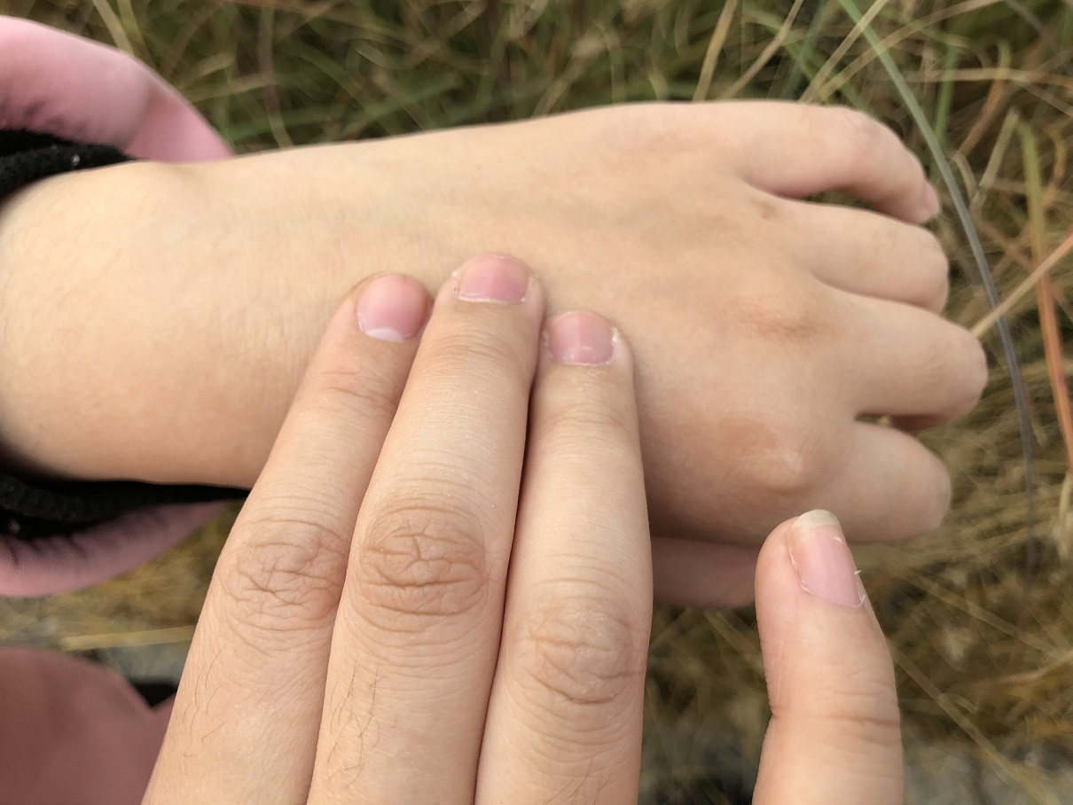 彻底解决敏感肌肤,告别敏感肌肤