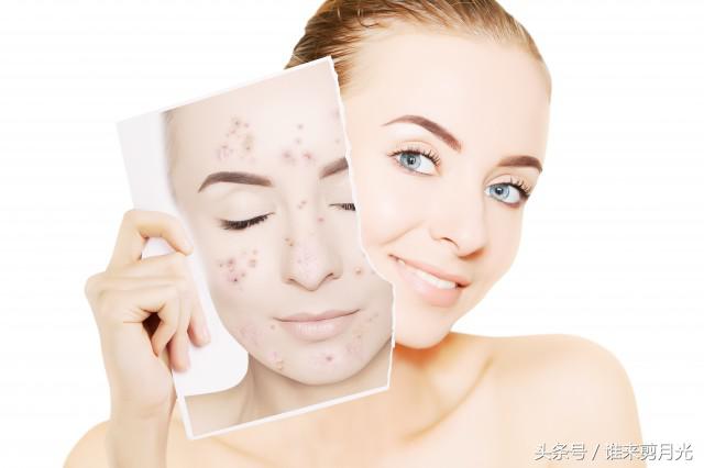 眉中间长痘痘是什么原因,眉中间长痘痘用什么药