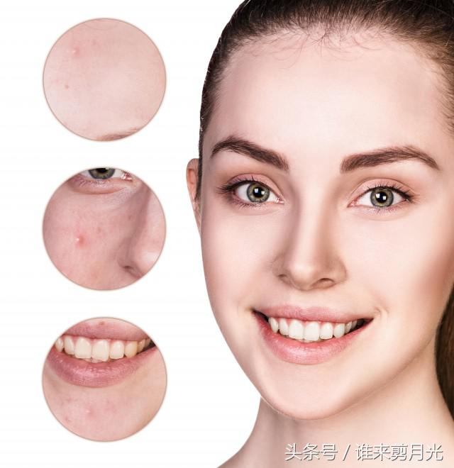 生完孩子后下巴额头长痘什么原因,额头下巴老是反复长痘怎么解决