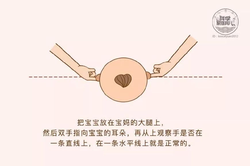 左边扁头偏头怎么睡矫正,先纠正扁头还是偏头