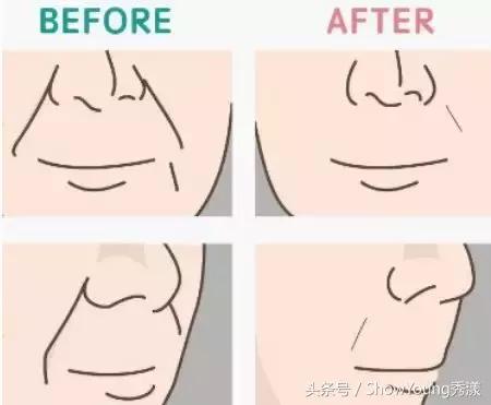 科普如何消除不同成因的法令纹,有法令纹与没有法令纹的区别