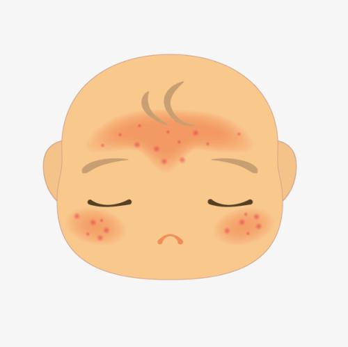 新生儿十天脸上有小红点怎么办,为什么新生儿脸上会有小疹子