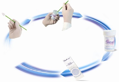 hpv和tct怎么看报告,宫颈hpvtct检查报告单