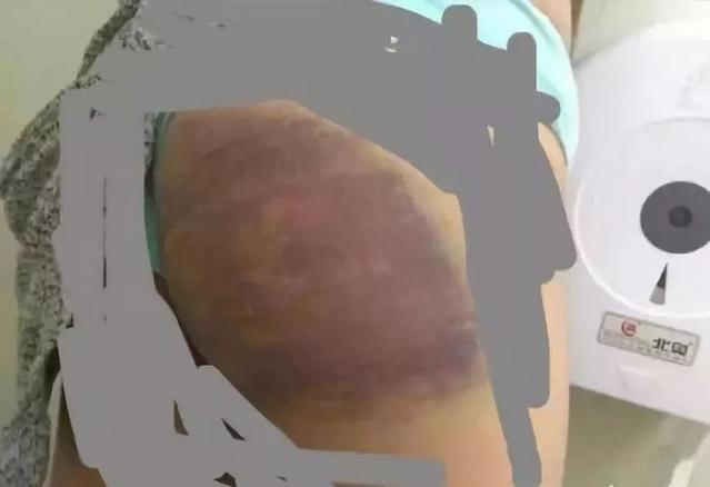 电击教授杨永信所在的临沂网戒所，传出一声声孩子惨叫……