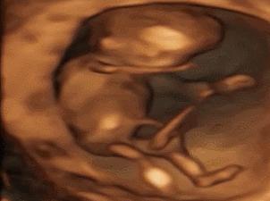 22周胎儿在肚子里的视频,22周胎儿在腹中真实照片