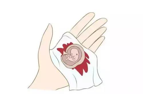 药流跟人流危害对比指数,药流有效还是人流有效