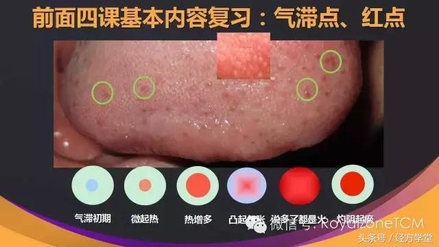 经方学堂一起学习舌诊,中医舌诊视频教程第一讲