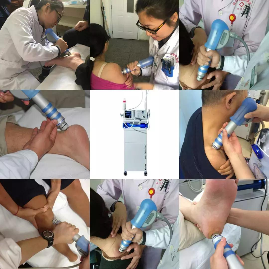 来自瑞士的神器——体外冲击波