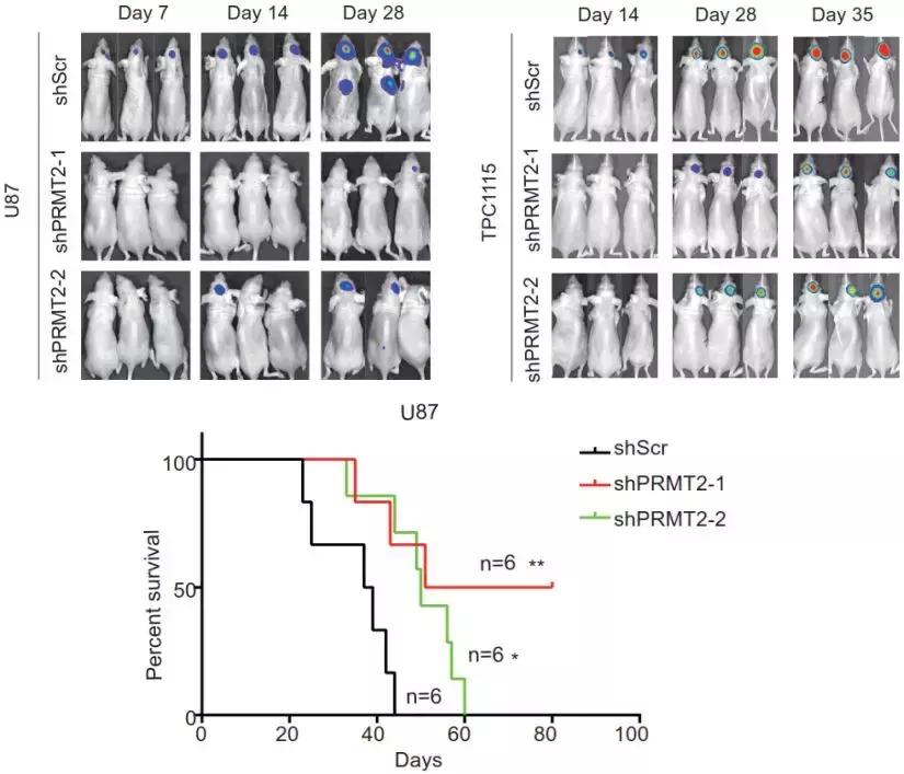 切除阑尾与pd关系,切阑尾怀疑肿瘤