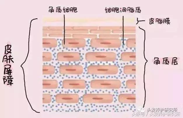 去头皮屑是控油还是去屑,去头屑用硫磺还是康王